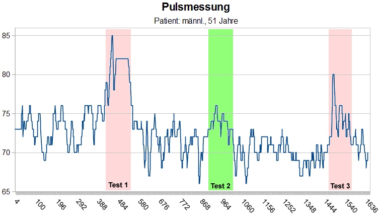 HYPNOseda Pulsmessung